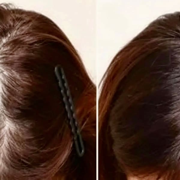 分け目が薄くなってきた。広がってきた方必見