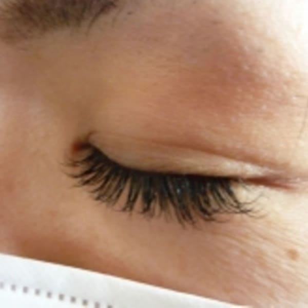 目元の印象を変えたい方に|VENUS