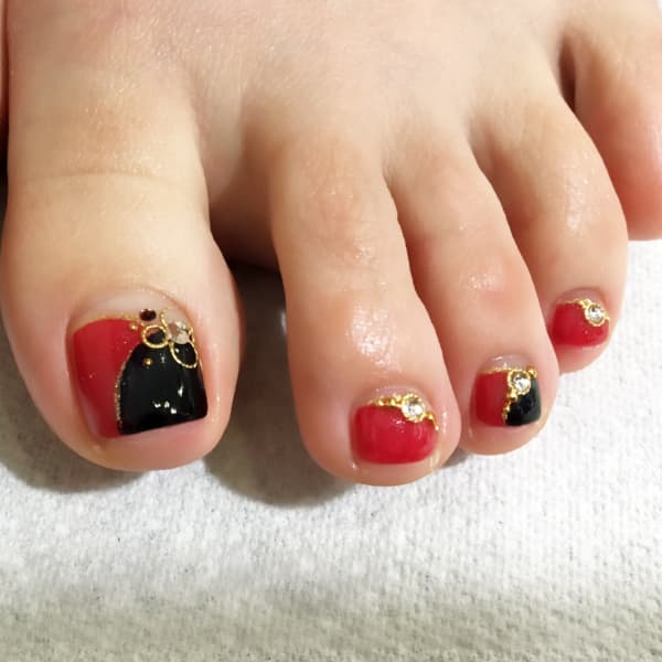 巻爪にお悩みの方は是非ご相談ください!|Olivier