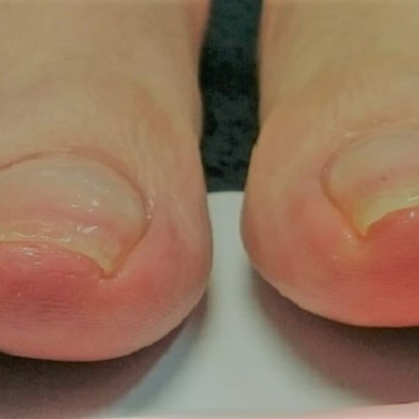 B/Sブレイス　１本￥3.300|bi.grace nail