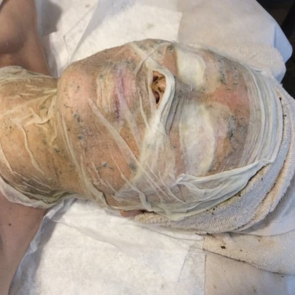 【ハーブトリートメント】老化、シミ、シワ、たるみの改善、くすみ、アクネや毛穴に 背中・腕のブツブツ|ruby-coco