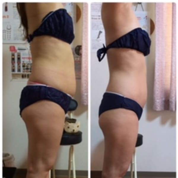 20代〜40代の方に人気|キャルム