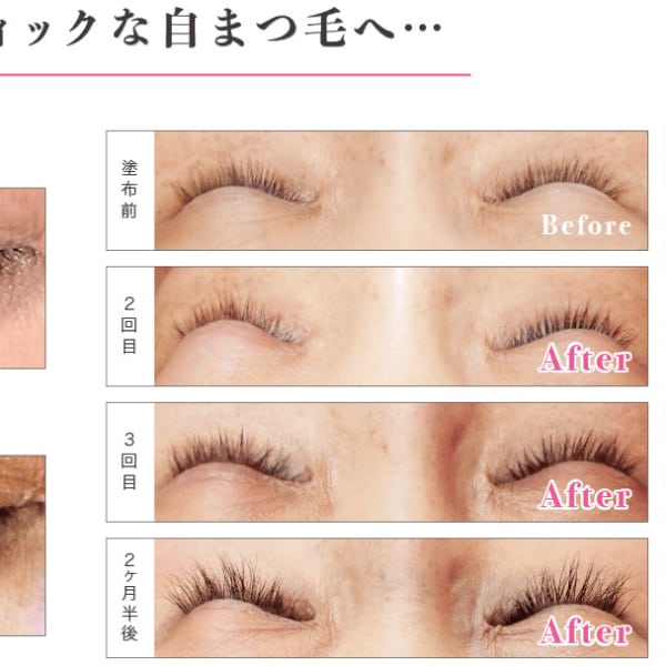 自まつ毛のトリートメント☆ラッシュアディクト　￥4,400|＆.BY