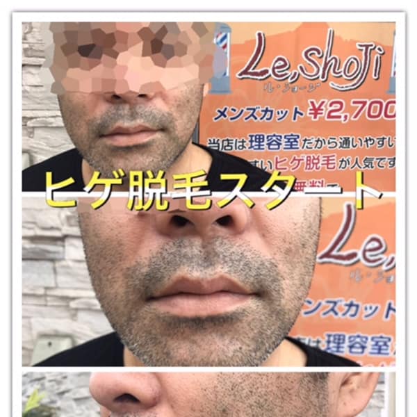 【ヒゲ脱毛】初回ヒゲ全体￥3800～|理容室半個室２席完備ヘアーステーション Le・shoji