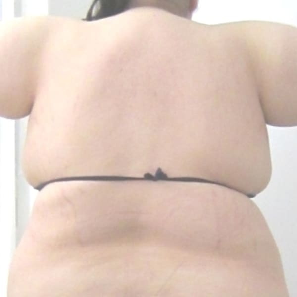 マイナスαの料金体系は「次回割制」の都度払い会計！コース契約無し！無理な商品販売無し！|ダイエットサロン マイナスアルファ