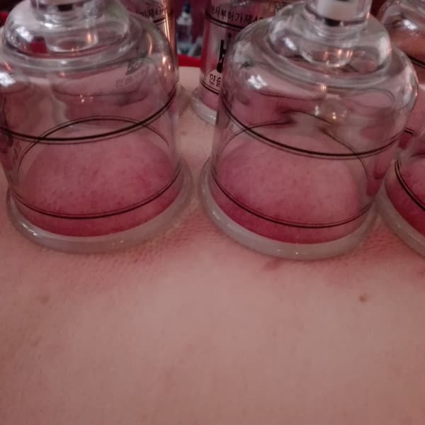 吸い玉で【代謝アップ・むくみスッキリ】お背中の固い甲羅を脱ぎ去りましょう☆彡|猫のいるタイ古式マッサージサロン にゃんぐりら