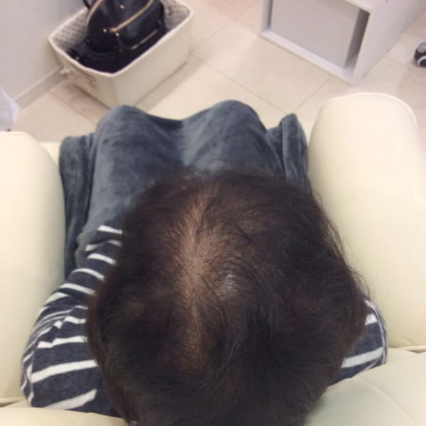 気になる薄毛や生えグセ隠しに！|flow TOTAL BEAUTY