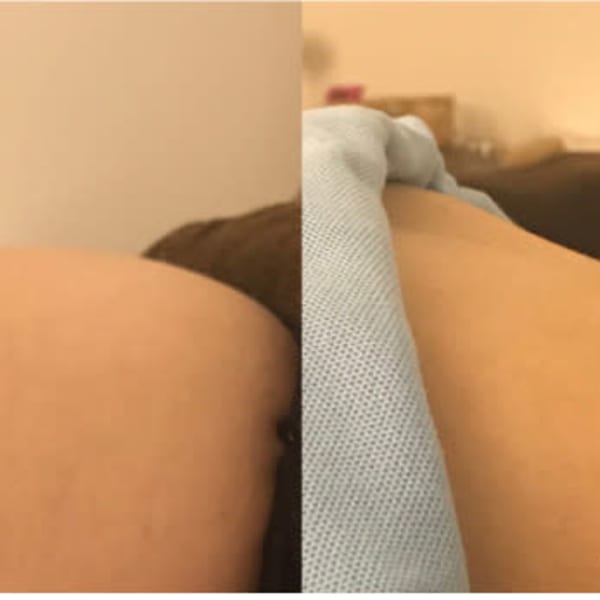 手っ取り早く、とりあえずお腹が痩せたい方へ人気のメニュー 超腸もみメソッド|即痩せ専門むくみ研究所心斎橋店