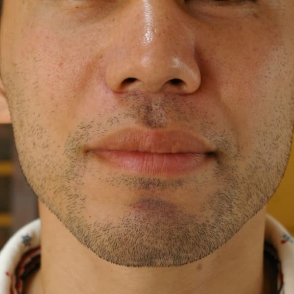男性脱毛・光フェイシャルに特化したサロン！30年の実績と、メニューは全て都度払い会計のコースなし|脱毛工房 SaKoN