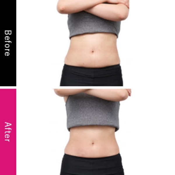 地上波TBS系【がっちりマンデー】でガチンコ取材！！新未来型痩身機【インナーインパクト】超短波|SPA・DOOM 南草津