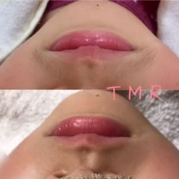 子どもの濃いヒゲ、まゆ毛つながり...どうにかしてあげたい(>_<)|エステサロンTMR