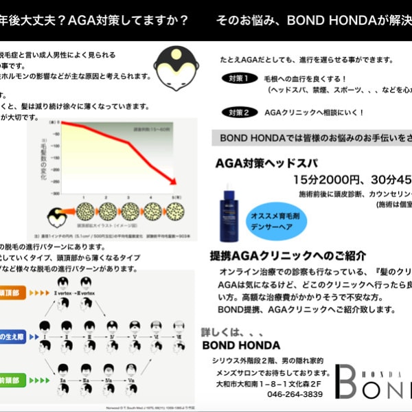 あなたの5年後大丈夫?AGA対策してますか?|BOND HONDA