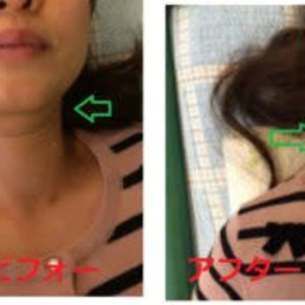 『やすらぎ山下整体療院』の【美顔小顔美容整体】|やすらぎ山下整体療院