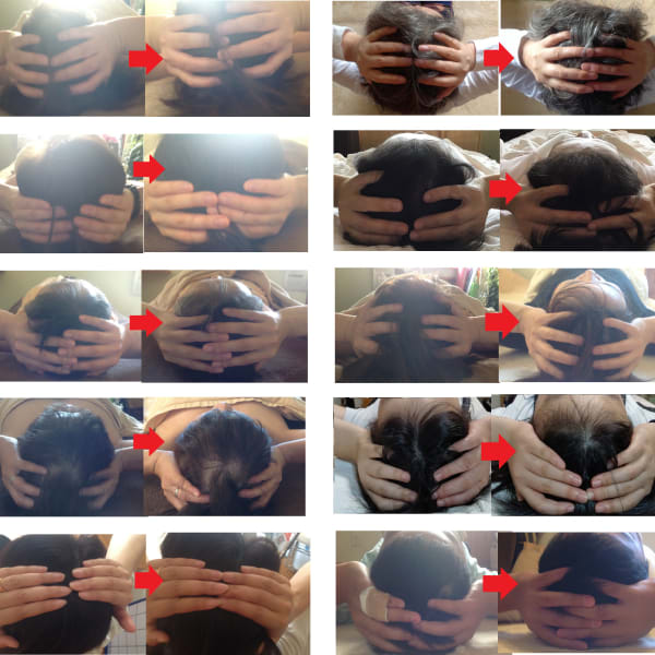 顎関節や頭蓋骨の歪み、慢性眼精疲労、顔の左右非対称を整える施術をトレーニングで受けれられます。|G-salon