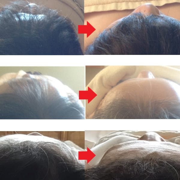 頭蓋骨の歪みや顎関節を整えると整形もしていない顔の形状が整います。|G-salon