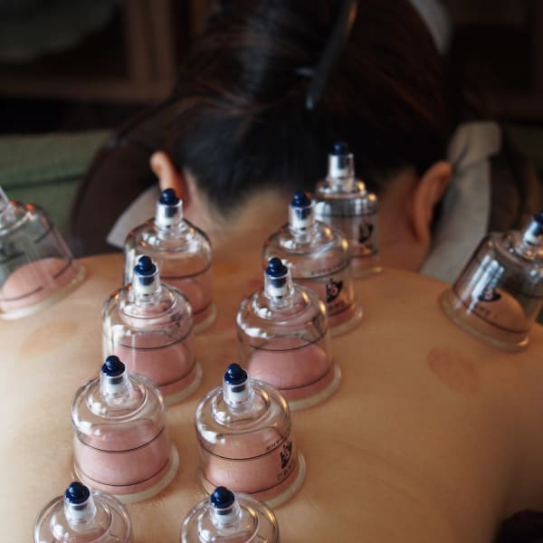 【肩こりや腰痛にお悩みの方デトックスしたい方へ】カッピング|アーユルヴェーダ&体質改善エステ アユレ