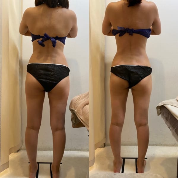 McCOY式筋膜リリース|Royal Therapist 袋町店