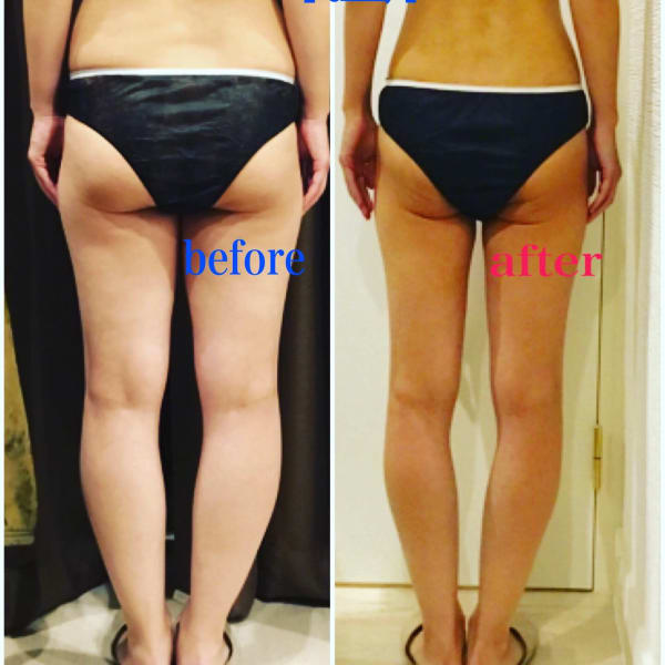 結果重視! フォースカッター　下半身瘦せコース￥8800|beauty studio OJAS