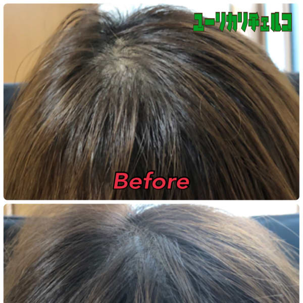『発毛実績98%以上』薄毛改善！本格実績を誇る【発毛.育毛】メニューを【プライベート半個室の空間】で|【髪質改善.頭皮改善専門】ユーリカリチェルコ