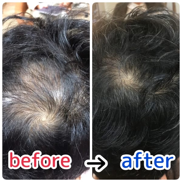 頭皮改善|RoomieRoom