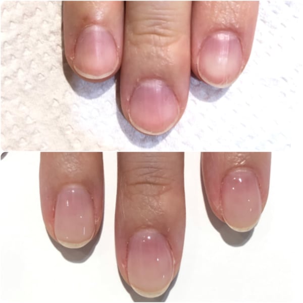 【特殊技術】深爪、トラブル爪対応サロン☆爪のお悩みがある方ご相談ください|Limi Nail