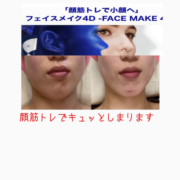 フェイスライン気になりませんか？※個人の事例であり、効果には個人差があります　|オアシス・さくら