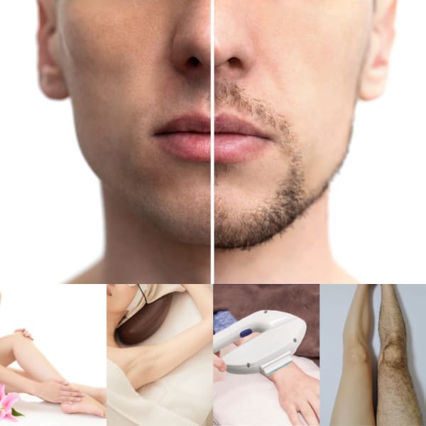 男女OK!美肌仕上げ♪全顔/VIO/顔~光脱毛◆2種の手法を組合せたハイブリッド脱毛!保湿美肌ケア付|Beaute et sante 川崎駅前