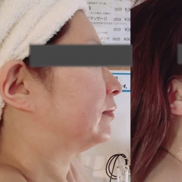 小顔エステ|美と学びAngela