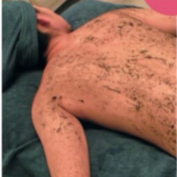 【REVI陶肌トリートメント 背中、大丈夫?】背中美人に導きます☆ブライダルにもおすすめ!|早く結果が出るサロン absoluteアブソリュート