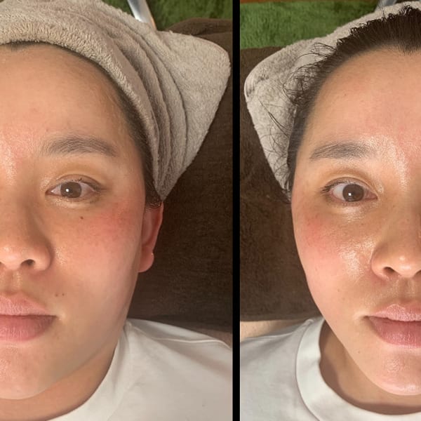 【 ツヤ美肌・小顔になりたい・たるみ、くすみ解消・エラ張り】ツヤ肌オイルフェイシャル&小顔矯正|女性のためのホリスティックサロン Polestar