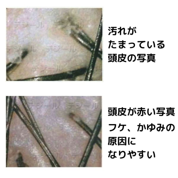頭皮の汚れは髪のトラブルの原因に…|デジール心斎橋店