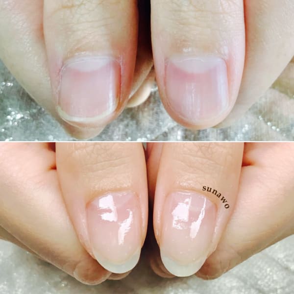 【自爪育成】【深爪矯正】爪のお悩みの相談お受けいたします|Nail Salon sunawo