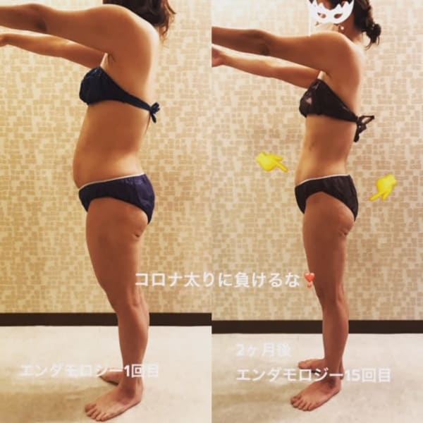 【痩せるチャンス★本気の方限定モニター募集中】|atriz