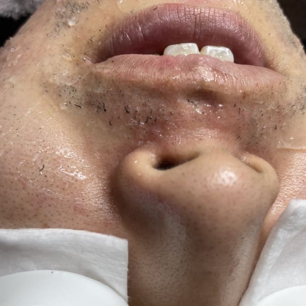 【つるつる男子増えています★】全身脱毛40,000円 部分脱毛 平日限定割あり|Men's salon BIO PLUS