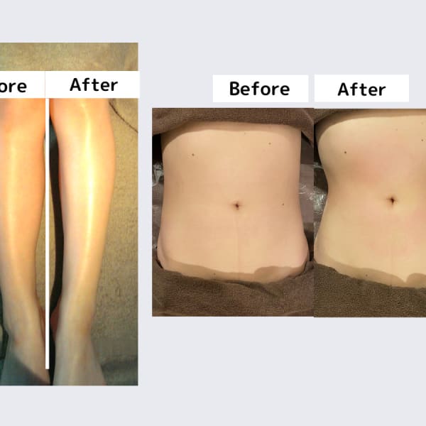 あなたの「やせたい」に本気で応えてくれる!|【 痩身 / ピーリング / バストUP 】 ビューティースリムreborn銀座店