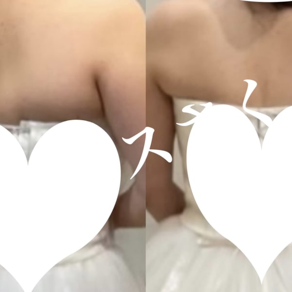 痩せるとドレスが似合います※個人の事例であり、効果には個人差があります　|オアシス・さくら