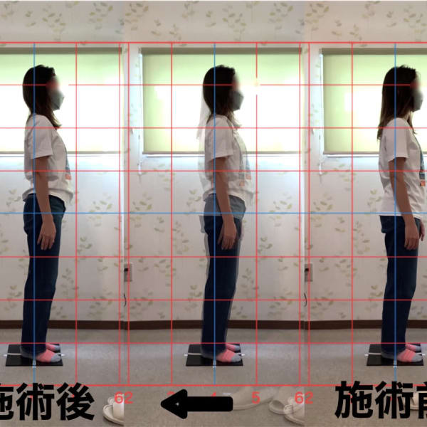 施術ビフォーアフター|あした葉整体院