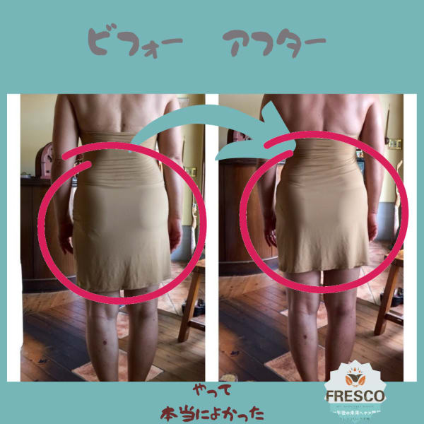 美容矯正ボデイ　ビフォーアフター写真|セラピールームフレスコ