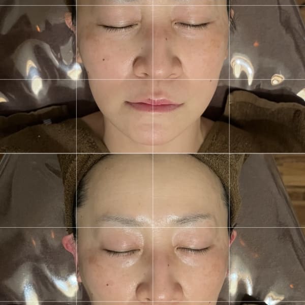 《まるで5~10年前のお顔⁉》【筋膜リリース】で驚きの小顔&リフトアップ♪|【エイジングケアサロン】lukka