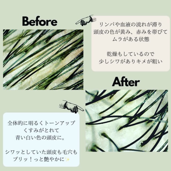 髪の乾燥うねりなどにお悩みの方には【コース2】エイジングケアエステで頭皮からキレイなツヤ髪に|エイジングケア ヘッドスパplanetz