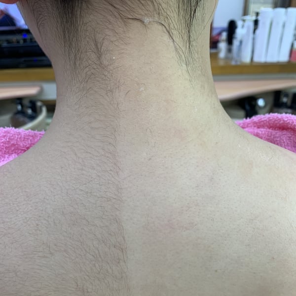 襟足のムダ毛&背中産毛を剃り綺麗に!美肌美白へ|理容室・美容室アムール