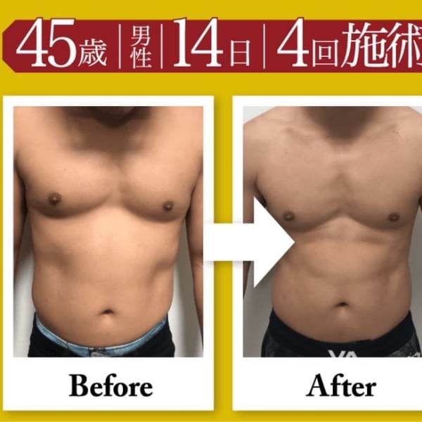 この夏本気で痩せませんか?|make Total Beauty メンズ眉毛|眉毛サロン