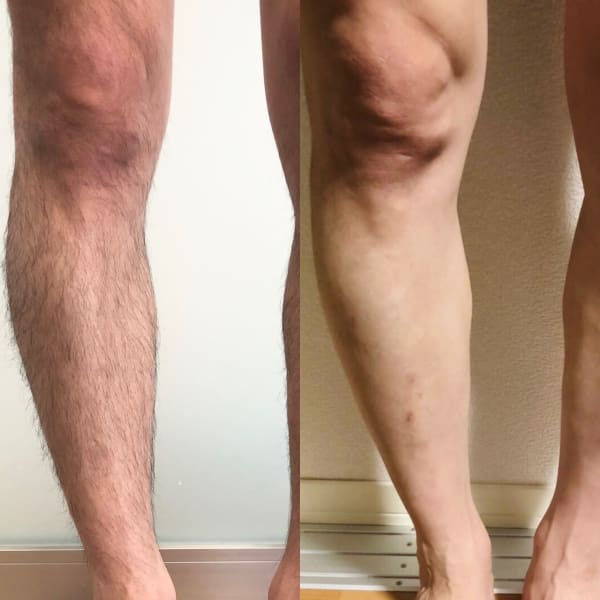 【make心斎橋店】光脱毛って本当に効果あるの?|make Total Beauty メンズ眉毛|眉毛サロン