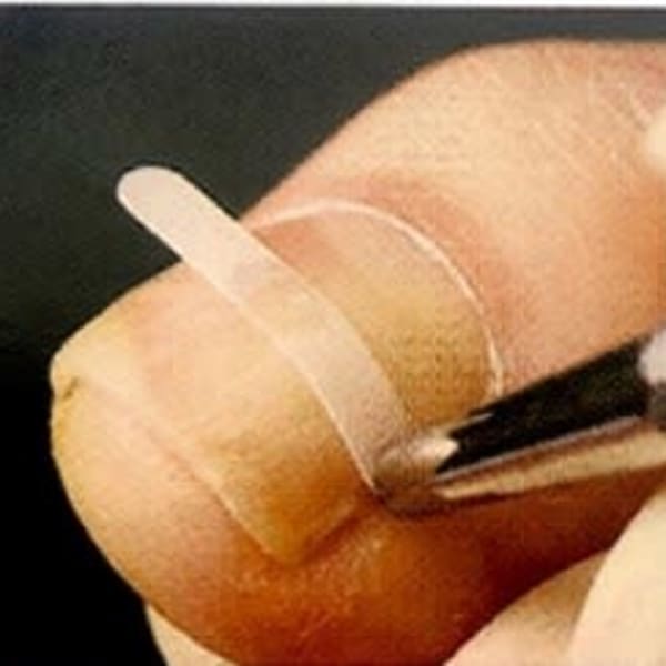 巻き爪補正 B/S Spange|リゼラアンドコー川越南古谷店