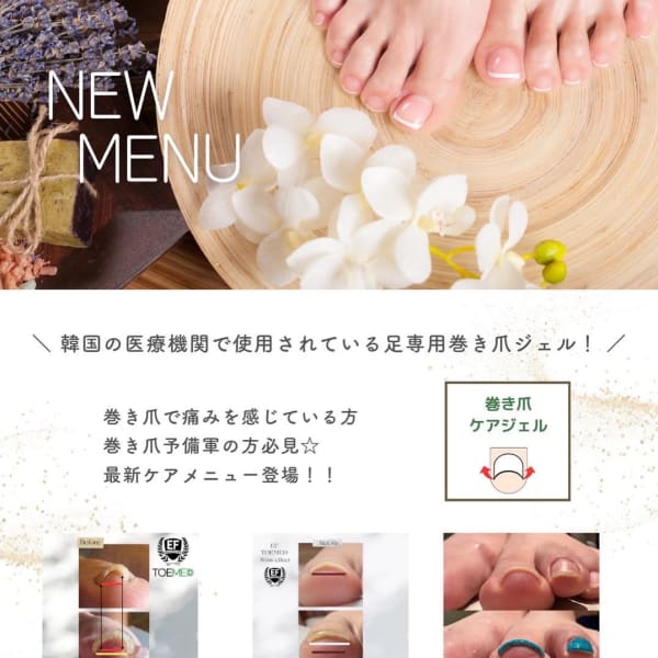 巻き爪で痛みを感じてる方、巻き爪予備軍の方必見！！巻き爪ケアジェルTOEMED導入店|LENAHC ARIA
