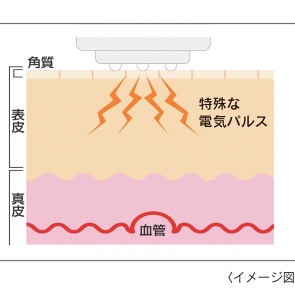 エレクトロポレーション法を使用した美顔機を導入|彩さ美岡山店