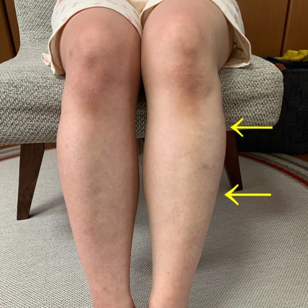 パンパンむくみ重だるい脚に!【ふくらはぎ高酸素オイル+極ゆるリンパ】|女性のためのホリスティックサロン Polestar