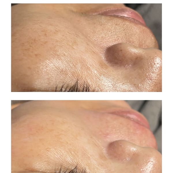 艶肌すぐ実感！感動のフェイシャルワックスで褒められ肌へ★|Beauty＆Spa Sereno