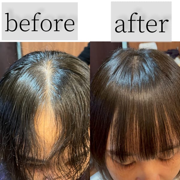 前髪割れ癖を改善！クロスパーマ/縮毛矯正も同時に癖と割れを治すハイブリッドストレート/西新|Sio. hair