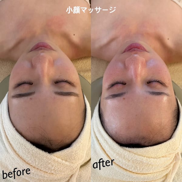 <水光ジェット>などフェイシャルメニュー多数!ツヤ・潤いたっぷりのツルンとしたモチ肌が実現★★|esthetic salon LA BEL